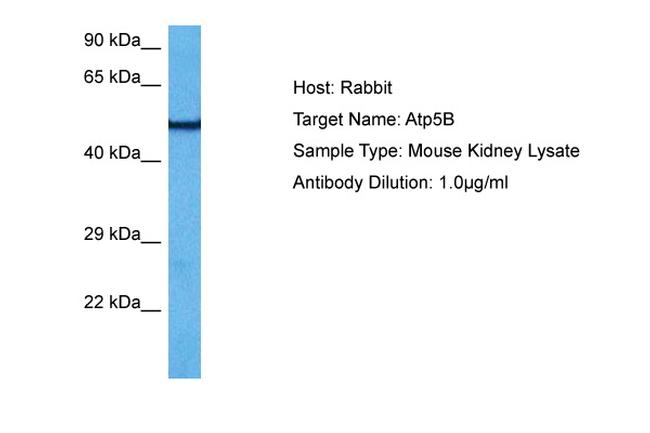 ATP Synthase beta Antibody in Western Blot (WB)