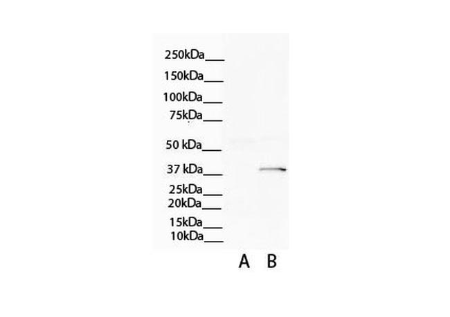 ATP6V0D2 Antibody in Western Blot (WB)