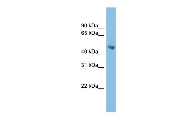 ADC Antibody in Western Blot (WB)