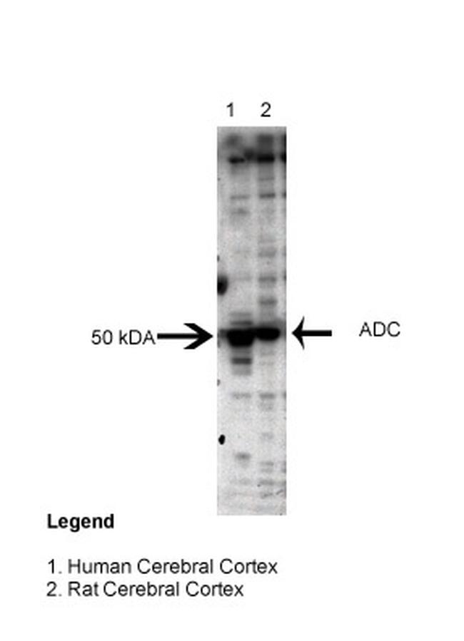 ADC Antibody in Western Blot (WB)