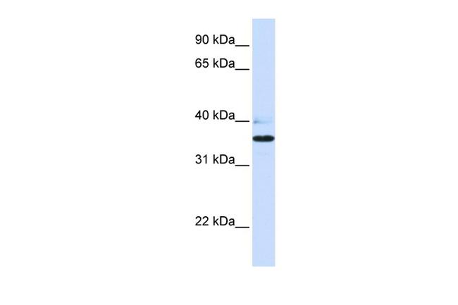 B3GALT1 Antibody in Western Blot (WB)