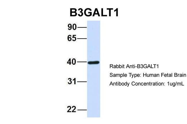 B3GALT1 Antibody in Western Blot (WB)