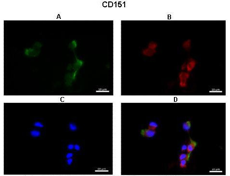 CD151 Antibody in Immunohistochemistry (IHC)