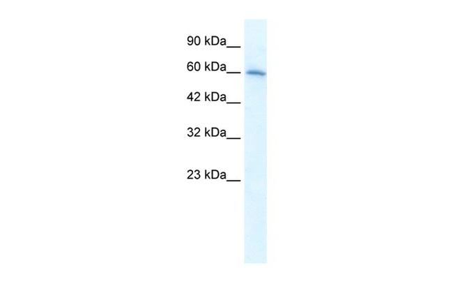 CHRNA7 Antibody in Western Blot (WB)