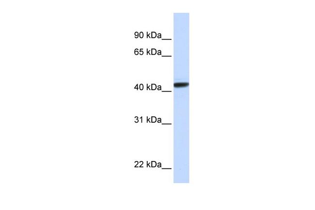 CLN8 Antibody in Western Blot (WB)