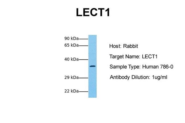 LECT1 Antibody in Western Blot (WB)