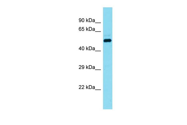 DCAF17 Antibody in Western Blot (WB)