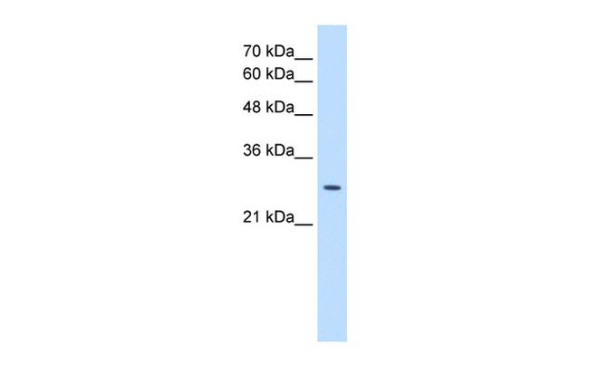 EBP Antibody in Western Blot (WB)