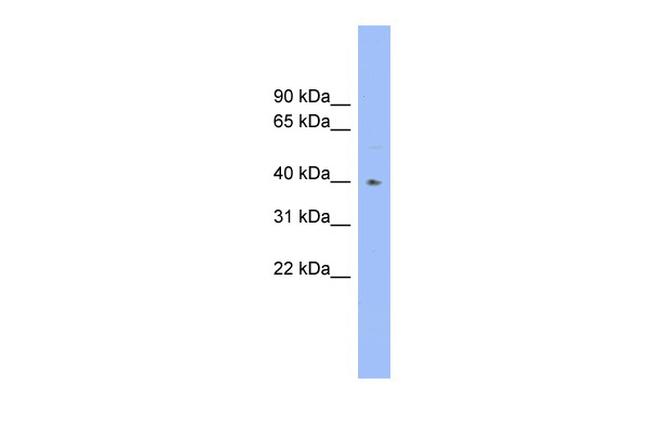 FUT1 Antibody in Western Blot (WB)