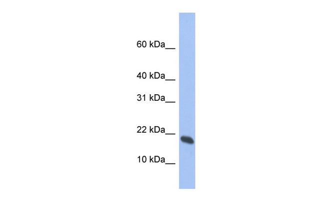 GMFG Antibody in Western Blot (WB)