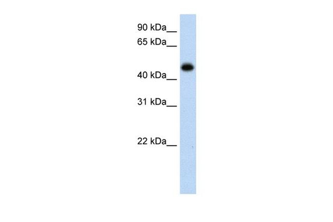 HAO1 Antibody in Western Blot (WB)