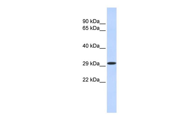 KLF14 Antibody in Western Blot (WB)