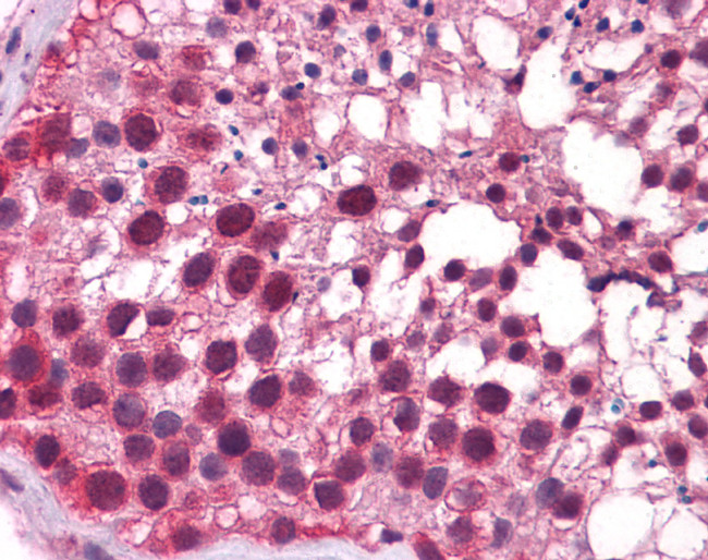 KLF9 Antibody in Immunohistochemistry (IHC)