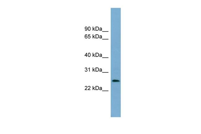 LIN37 Antibody in Western Blot (WB)