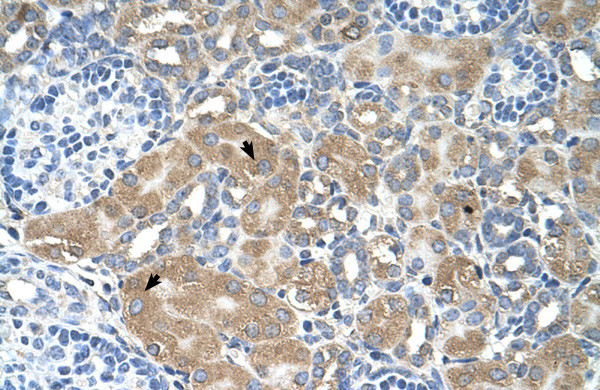 VIP36 Antibody in Immunohistochemistry (IHC)