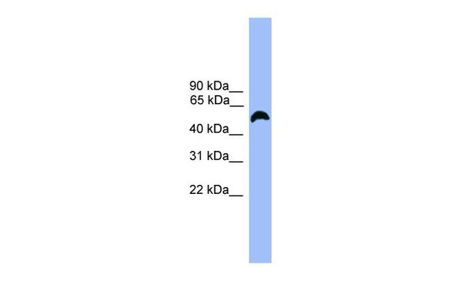 MARCO Antibody in Western Blot (WB)