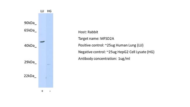 MFSD2A Antibody in Western Blot (WB)