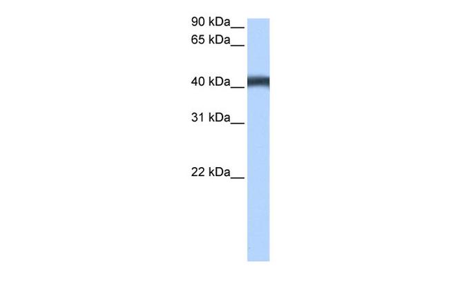 MFSD3 Antibody in Western Blot (WB)