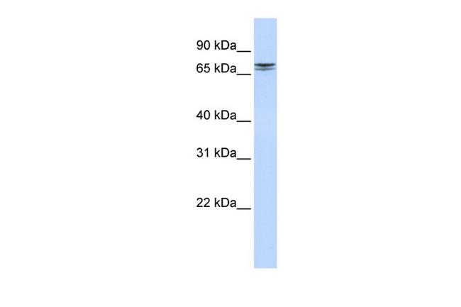 NCAPH2 Antibody in Western Blot (WB)