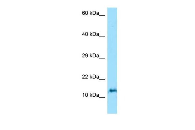 ORMDL3 Antibody in Western Blot (WB)