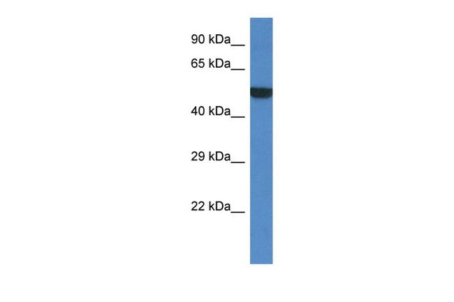 PORCN Antibody in Western Blot (WB)