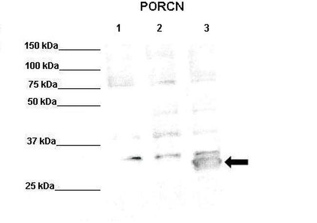 PORCN Antibody in Western Blot (WB)