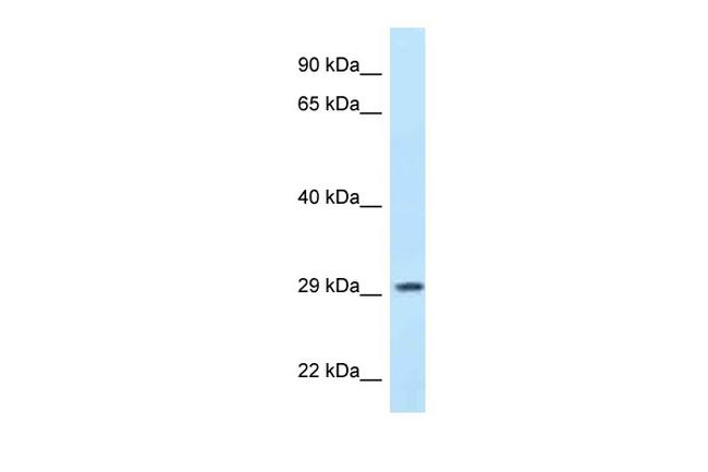 PPP1R3B Antibody in Western Blot (WB)