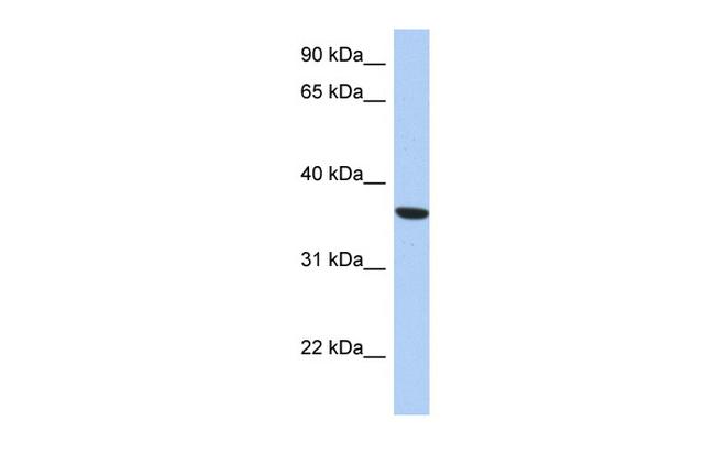 PSTK Antibody in Western Blot (WB)