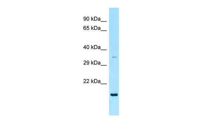 RAP2A Antibody in Western Blot (WB)