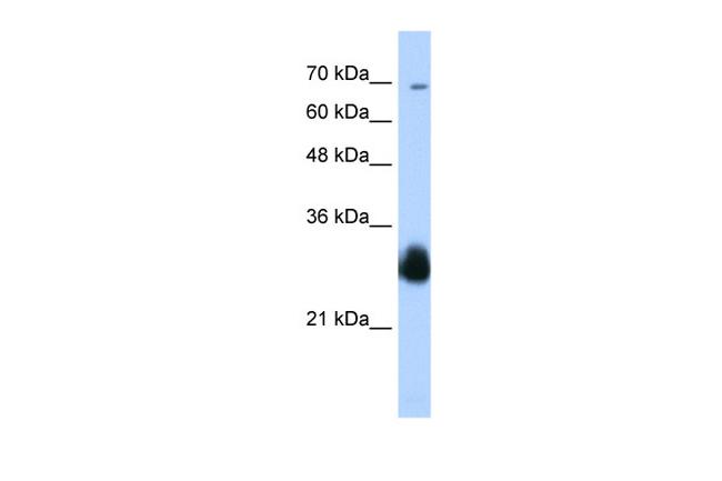 RNF138 Antibody in Western Blot (WB)