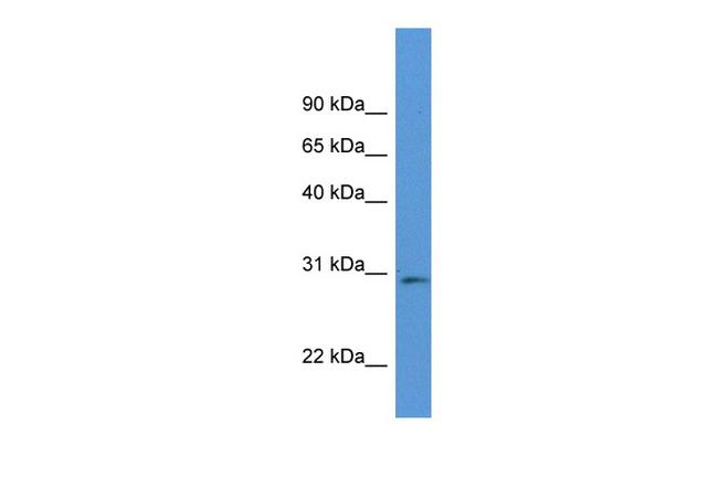 RPIA Antibody in Western Blot (WB)