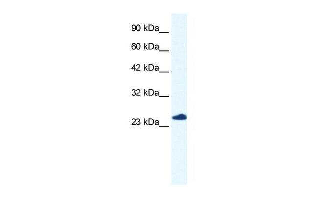 RTRAF Antibody in Western Blot (WB)