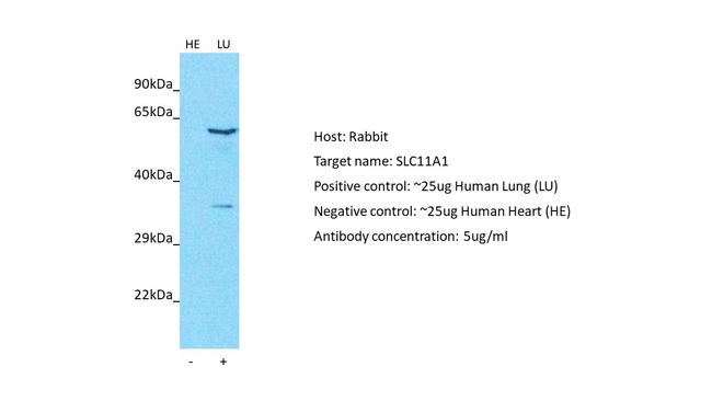 SLC11A1 Antibody in Western Blot (WB)