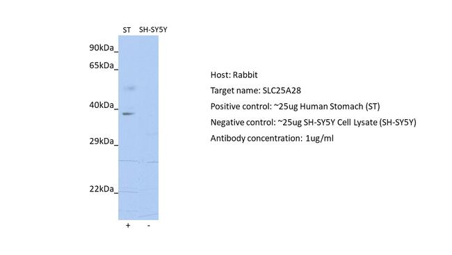 SLC25A28 Antibody in Western Blot (WB)