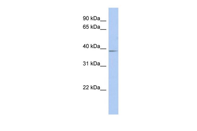 SLC25A28 Antibody in Western Blot (WB)