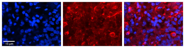 SLC27A6 Antibody in Immunohistochemistry (IHC)