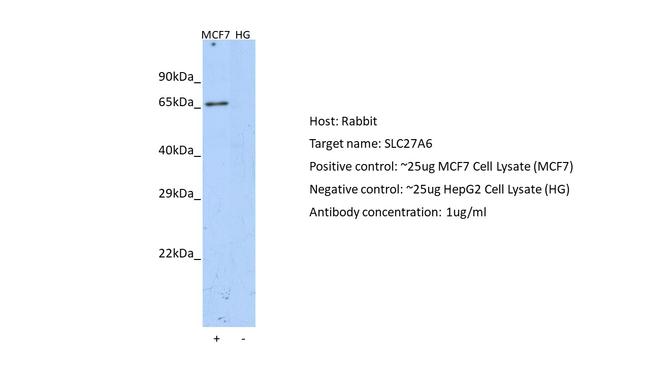 SLC27A6 Antibody in Western Blot (WB)