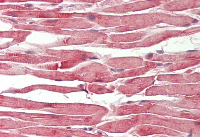 SLIRP Antibody in Immunohistochemistry (IHC)