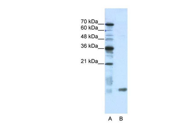 SLIRP Antibody in Western Blot (WB)