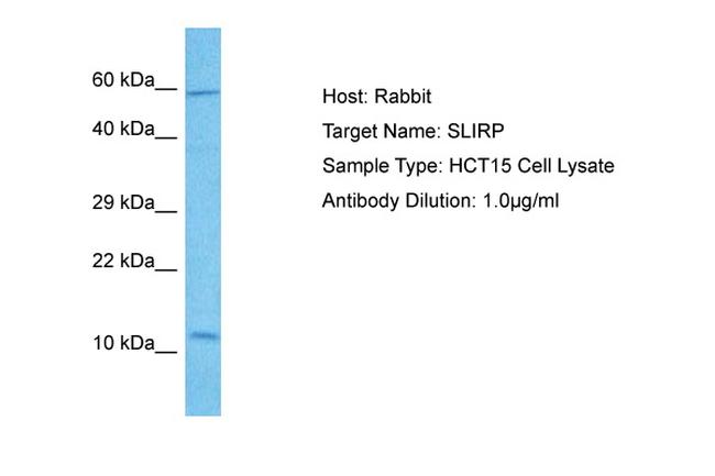 SLIRP Antibody in Western Blot (WB)