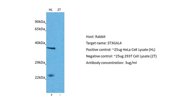 ST3GAL4 Antibody in Western Blot (WB)