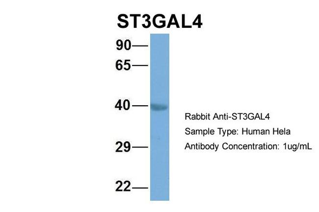 ST3GAL4 Antibody in Western Blot (WB)