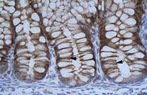 SUV39H1 Antibody in Immunohistochemistry (IHC)