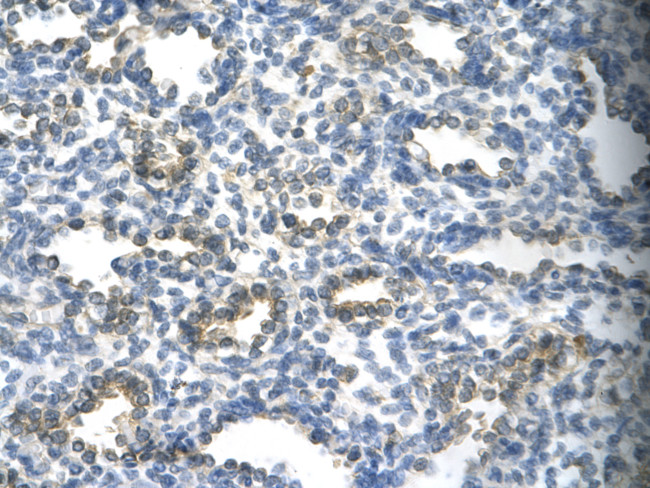 SUV39H1 Antibody in Immunohistochemistry (Paraffin) (IHC (P))