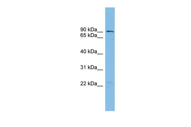 TBC1D16 Antibody in Western Blot (WB)