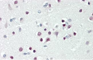 TBX15 Antibody in Immunohistochemistry (Paraffin) (IHC (P))