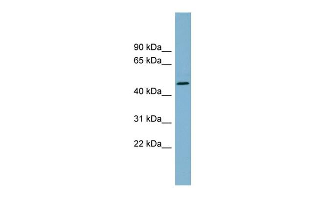 TDO2 Antibody in Western Blot (WB)