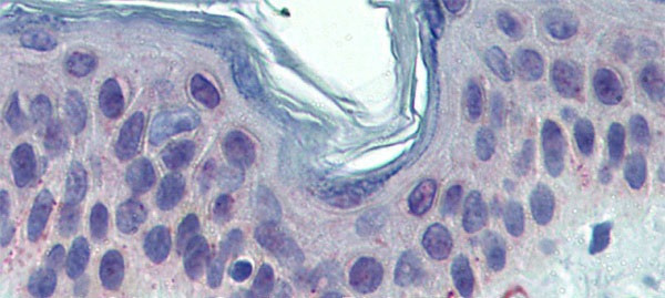 TYRP1 Antibody in Immunohistochemistry (Paraffin) (IHC (P))