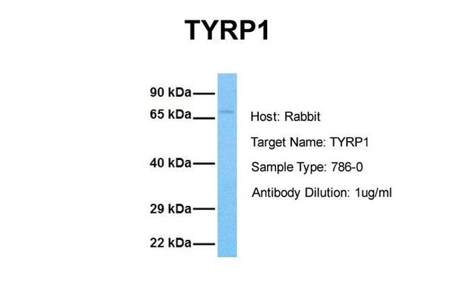 TYRP1 Antibody in Western Blot (WB)