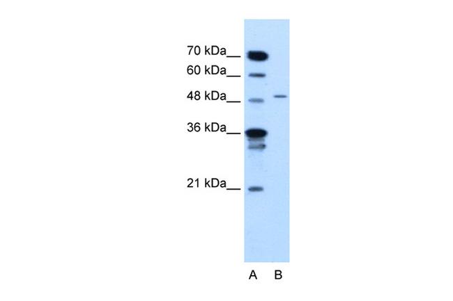 TYRP1 Antibody in Western Blot (WB)